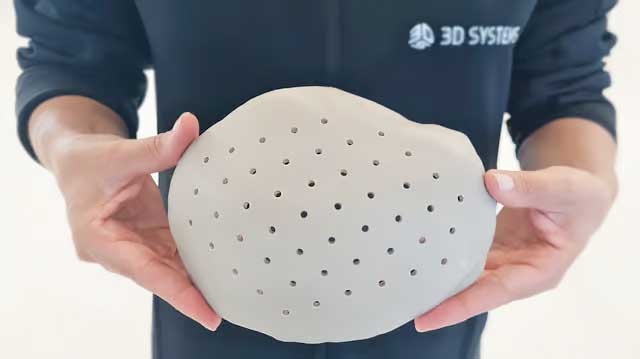 3D Systems 的 3D 打印 PEEK 颅骨植入物获得 FDA 批准