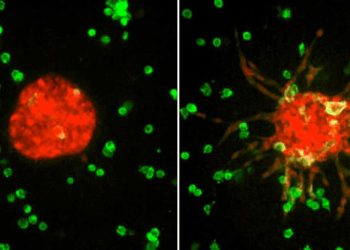 3D打印支持肿瘤细胞转移研究