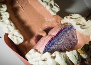 3D打印神经植入物旨在改善下颌手术的愈合